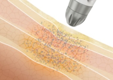 德國SEYO水光儀,LP3德國原裝進口安瓶,護膚,美容,醫思欣泰