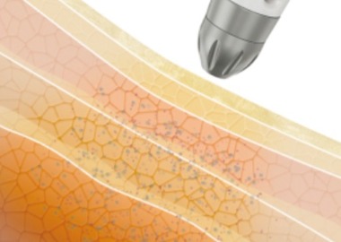 德國SEYO水光儀,LP3德國原裝進口安瓶,護膚,美容,醫思欣泰